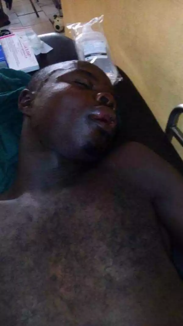 Unidentified Accident Victim Lying Unconscious At A Hospital In Abuja...[click to Read full]